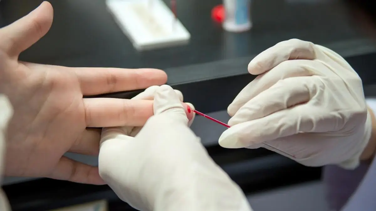 Establecimientos de salud municipal realizan test rápido del VIH