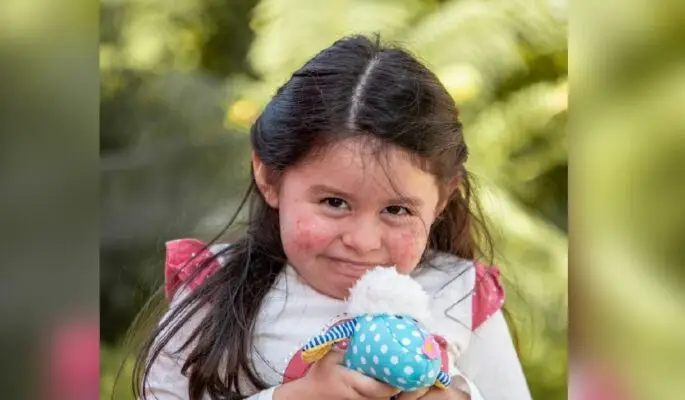Niña de Linares necesita trasplante de células madre para superar rara enfermedad