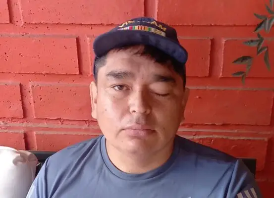 Este sábado se realiza bingo solidario para operación de curicano con tumor cerebral