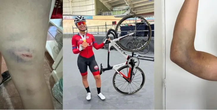 Ciclista curicana arriesga participación en competencia internacional tras sufrir accidente