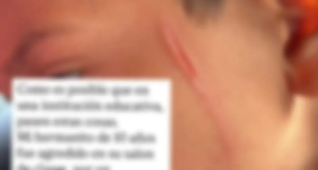 Madre denuncia ataque a su hijo con la hoja de un sacapuntas en la Escuela Palestina de Curicó