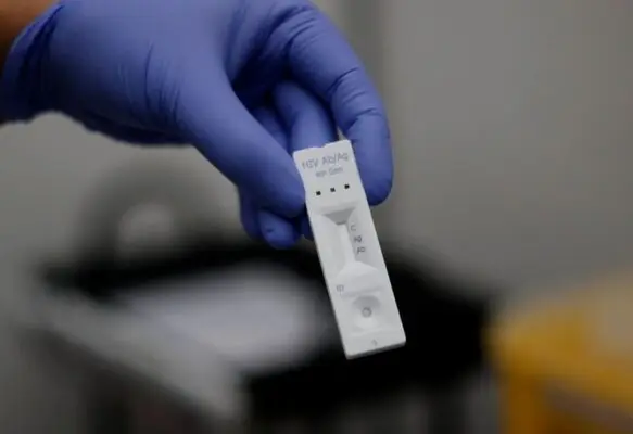 Concejala Pinto exige explicaciones en Curicó por falta de test rápidos de VIH en salud pública